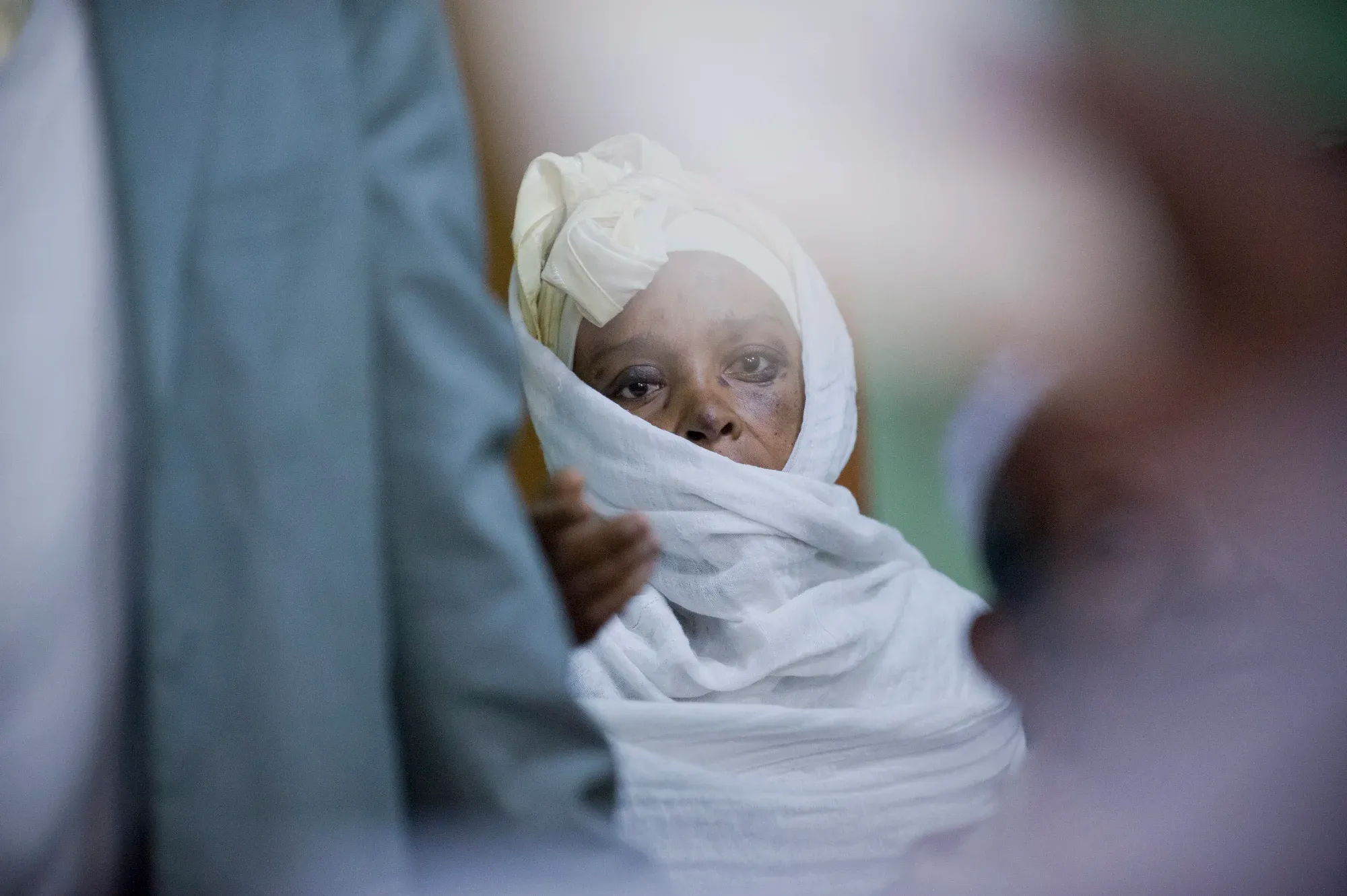 Breast Cancer, Ethiopia